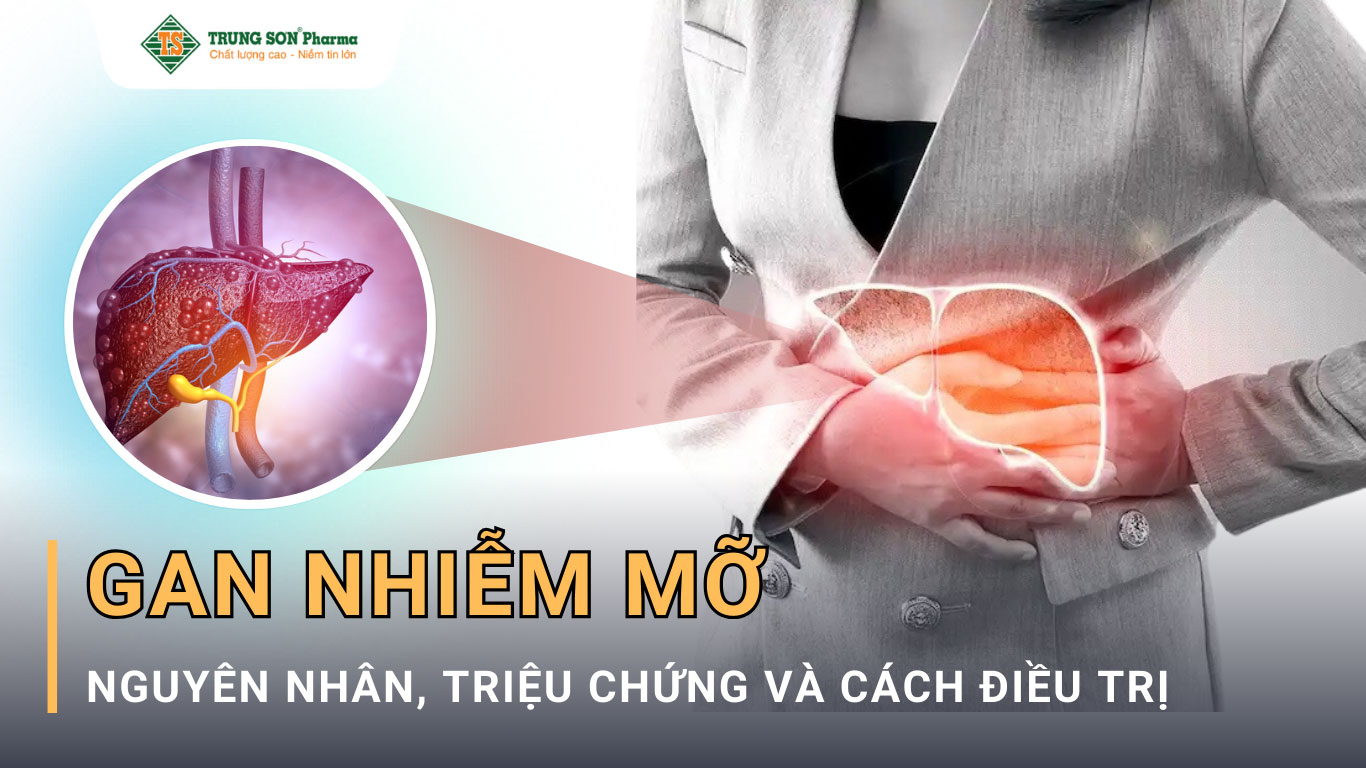 Bệnh gan nhiễm mỡ (FLD) là tình trạng có sự tích tụ mỡ trong gan