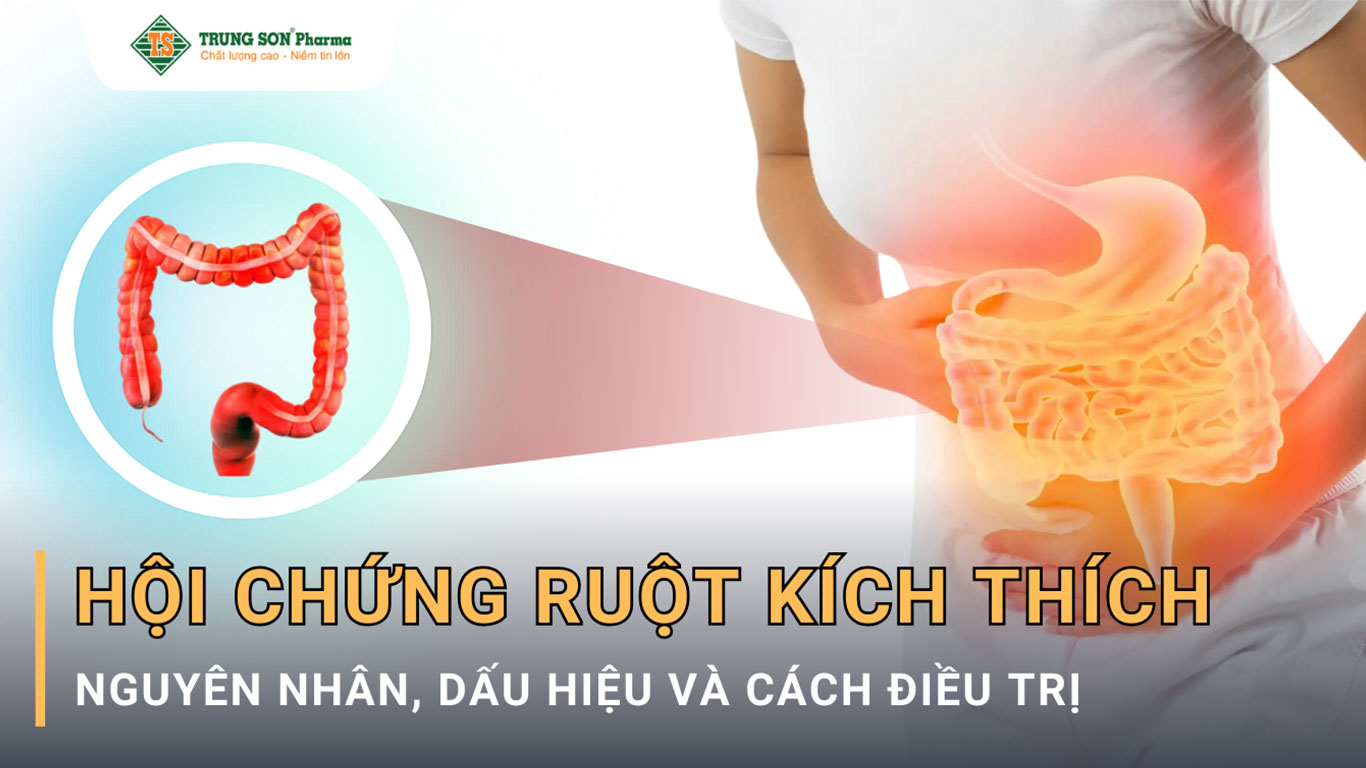 Hội chứng ruột kích thích (IBS) là một rối loạn thường gặp ảnh hưởng đến hệ tiêu hóa