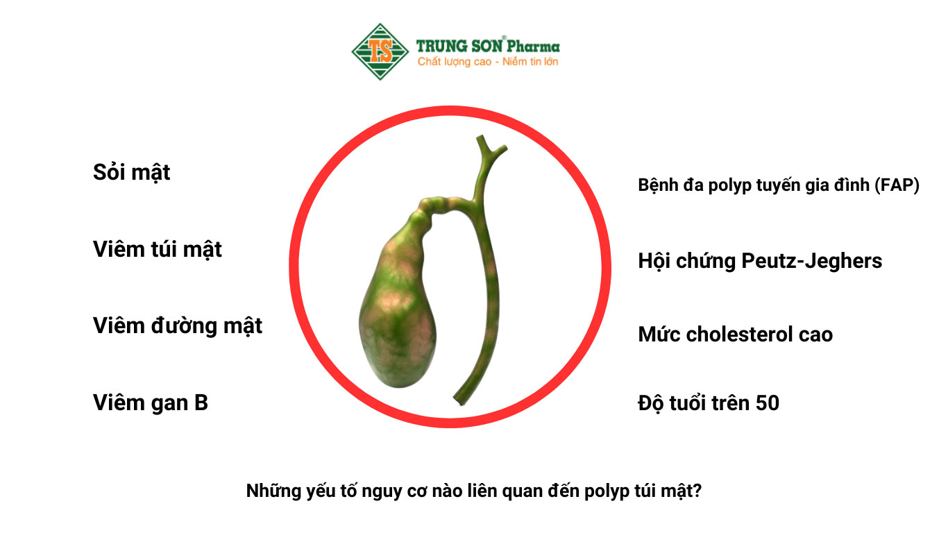 Những yếu tố nguy cơ liên quan đến polyp túi mật