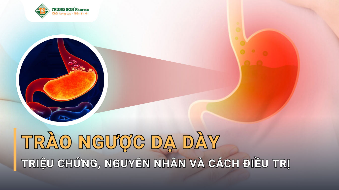 Trào ngược dạ dày thực quản