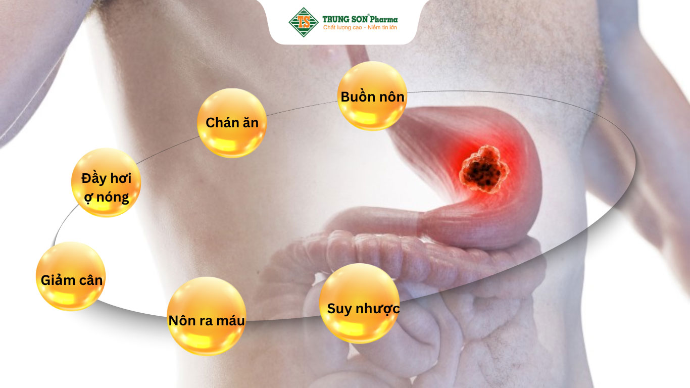 Triệu chứng ung thư dạ dày giai đoạn đầu