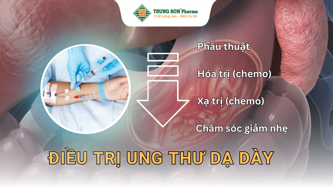 Điều trị ung thư dạ dày phụ thuộc vào mức độ lan rộng của bệnh