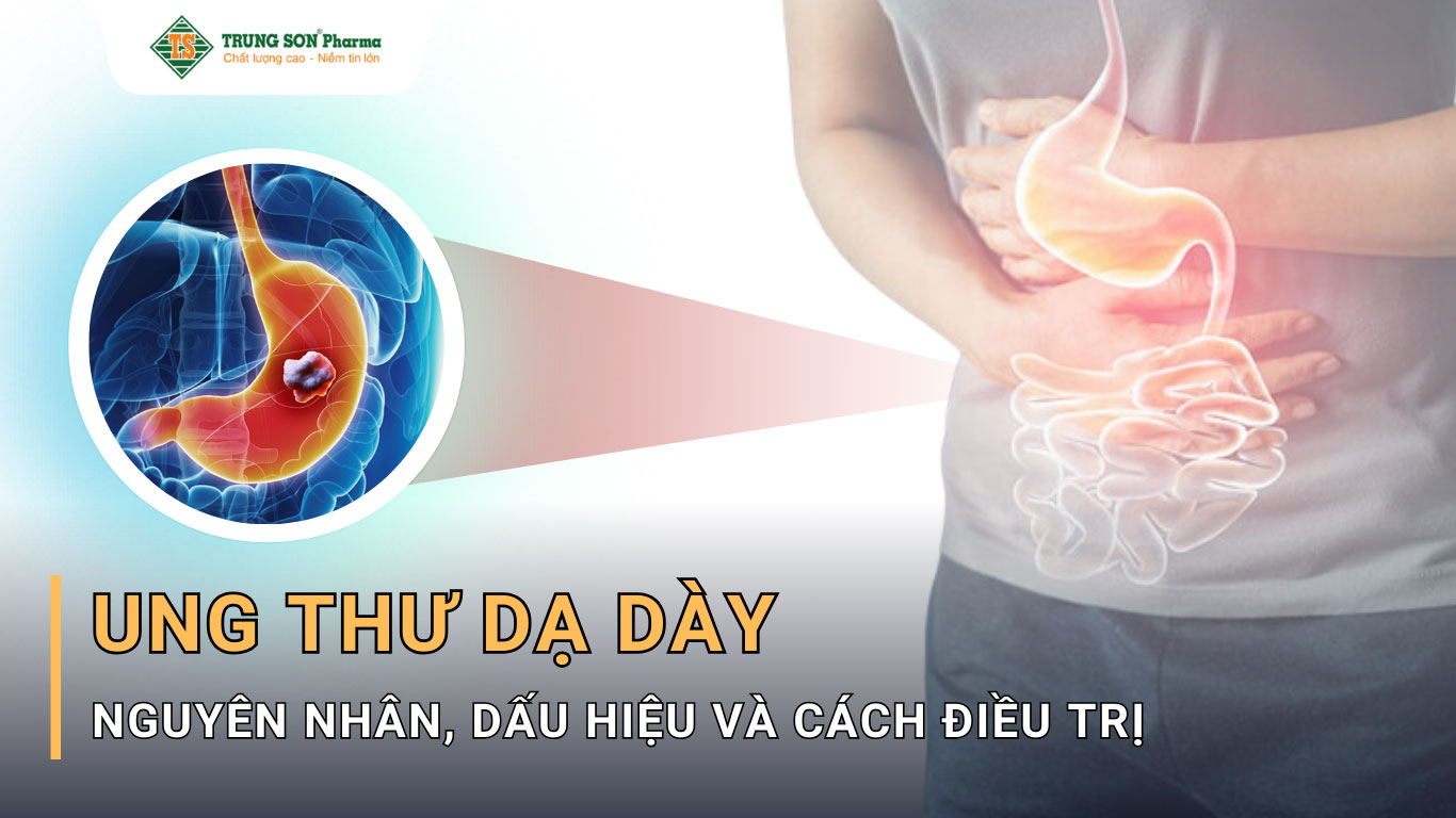 ung-thu-da-day-Ung thư dạ dày là loại bệnh ung thư phát sinh từ các tế bào trong dạ dày