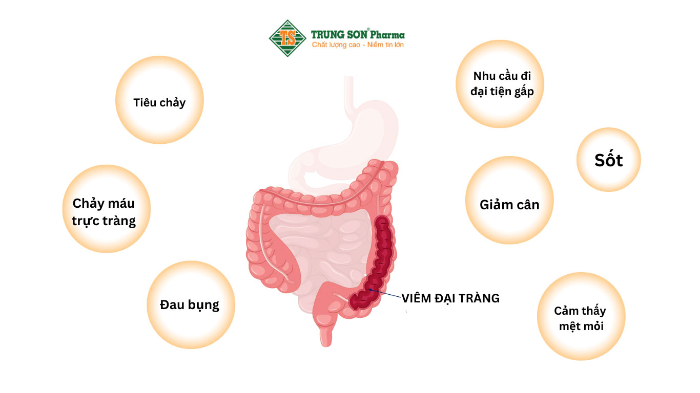 Dấu hiệu nhận biết bệnh viêm đại tràng