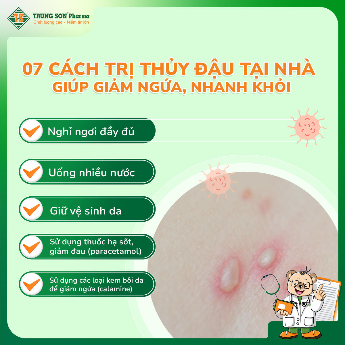 Người mắc thủy đậu nên được cách ly tại nhà trong khoảng 7-10 ngày