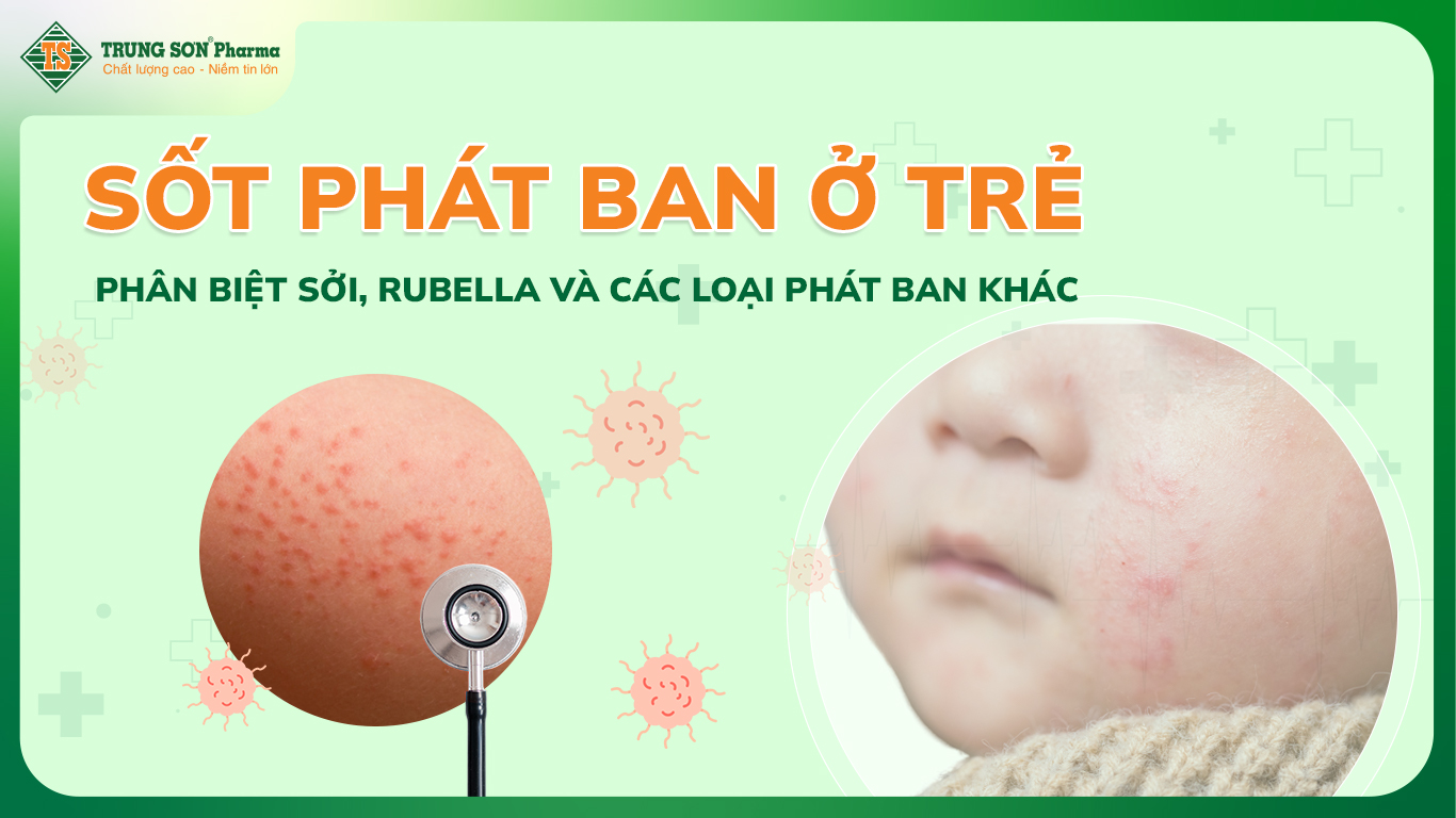 Sốt phát ban ở trẻ: Phân biệt sởi, rubella và các loại phát ban khác