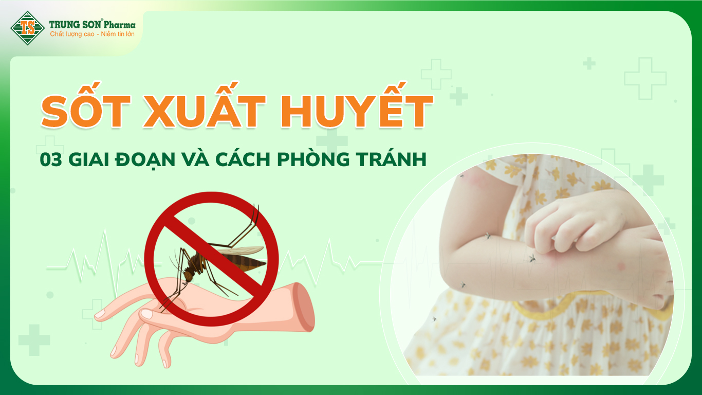 Sốt Xuất Huyết: 03 giai đoạn của bệnh và cách phòng tránh hiệu quả