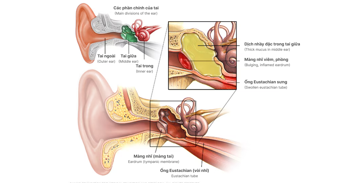 Sơ đồ cấu tạo tai (tai ngoài – tai giữa – tai trong).