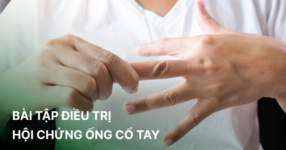 Các bài tập điều trị hội chứng ống cổ tay