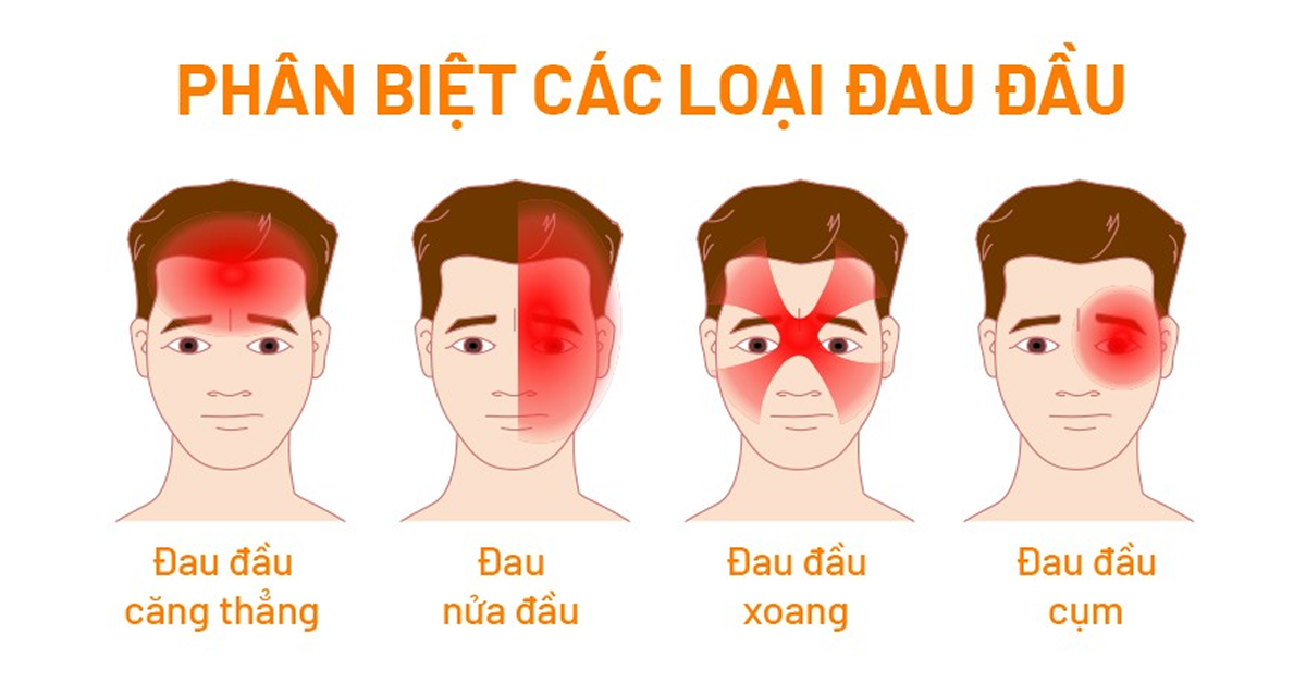 Phân biệt các loại đau đầu