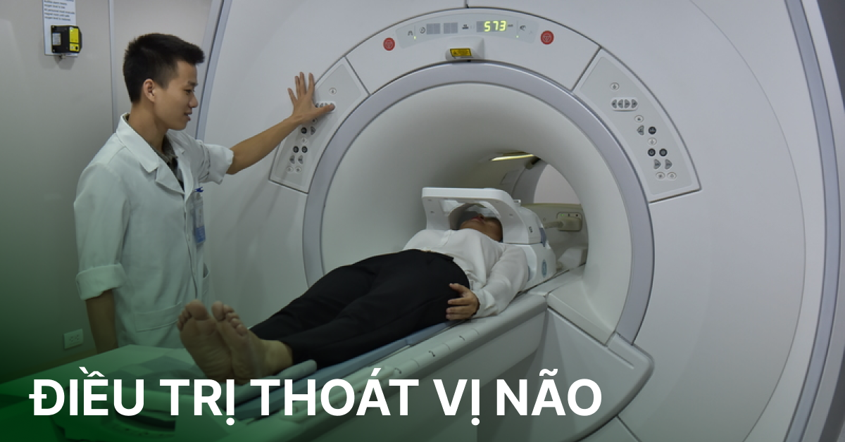 Điều trị thoát vị não