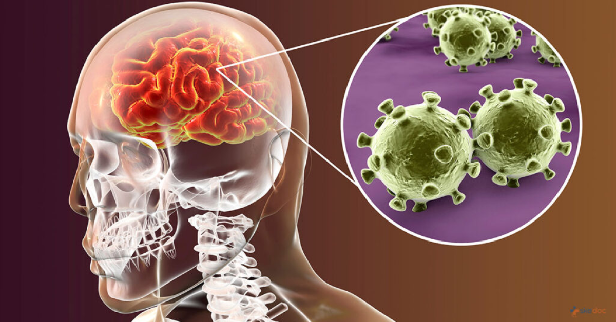 Viêm màng não và các tác nhân gây bệnh.