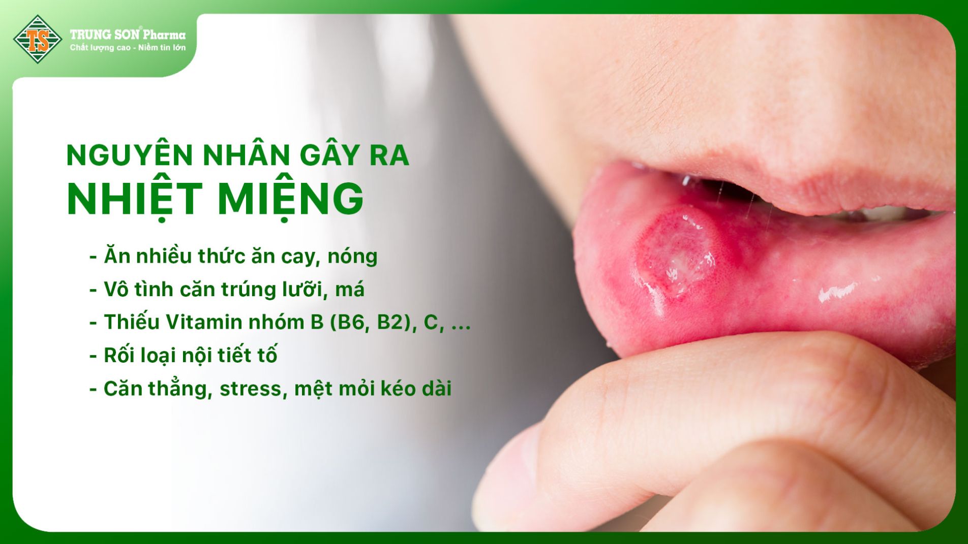 Nguyên nhân gây ra nhiệt miệng