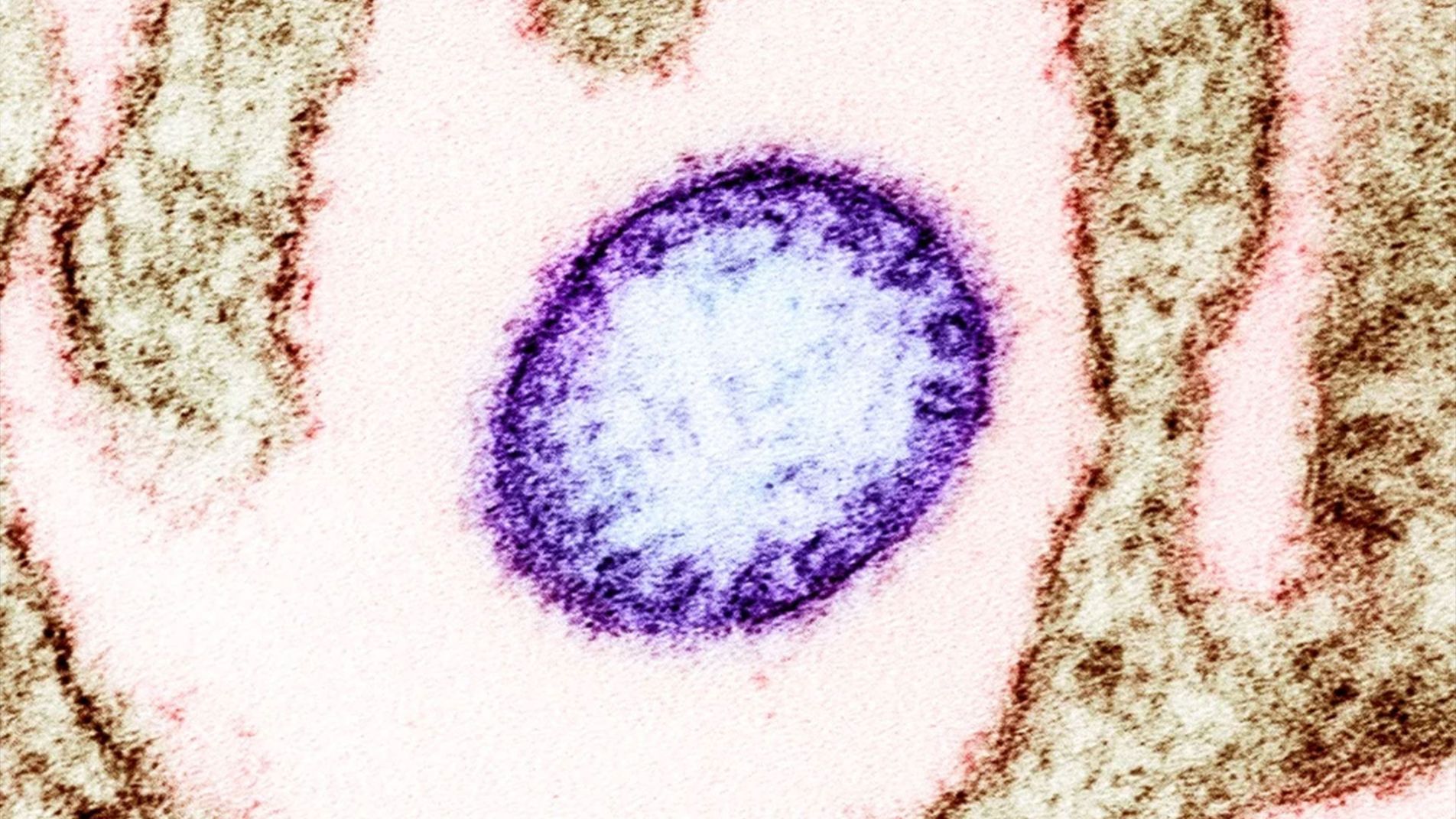 (Cấu trúc virus Nipah (NiV) dưới kính hiển vi điện tử, cho thấy hình dạng virus và lớp vỏ glycoprotein)