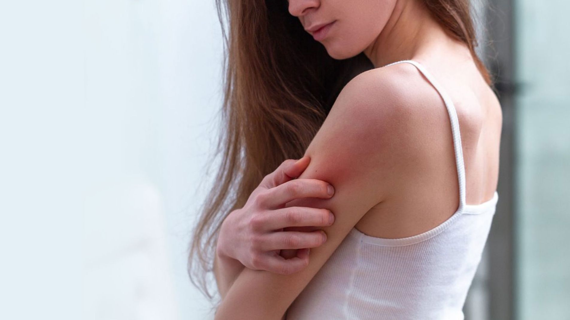 Nhận biết nguyên nhân và khắc phục tình trạng phát ban đỏ trên da