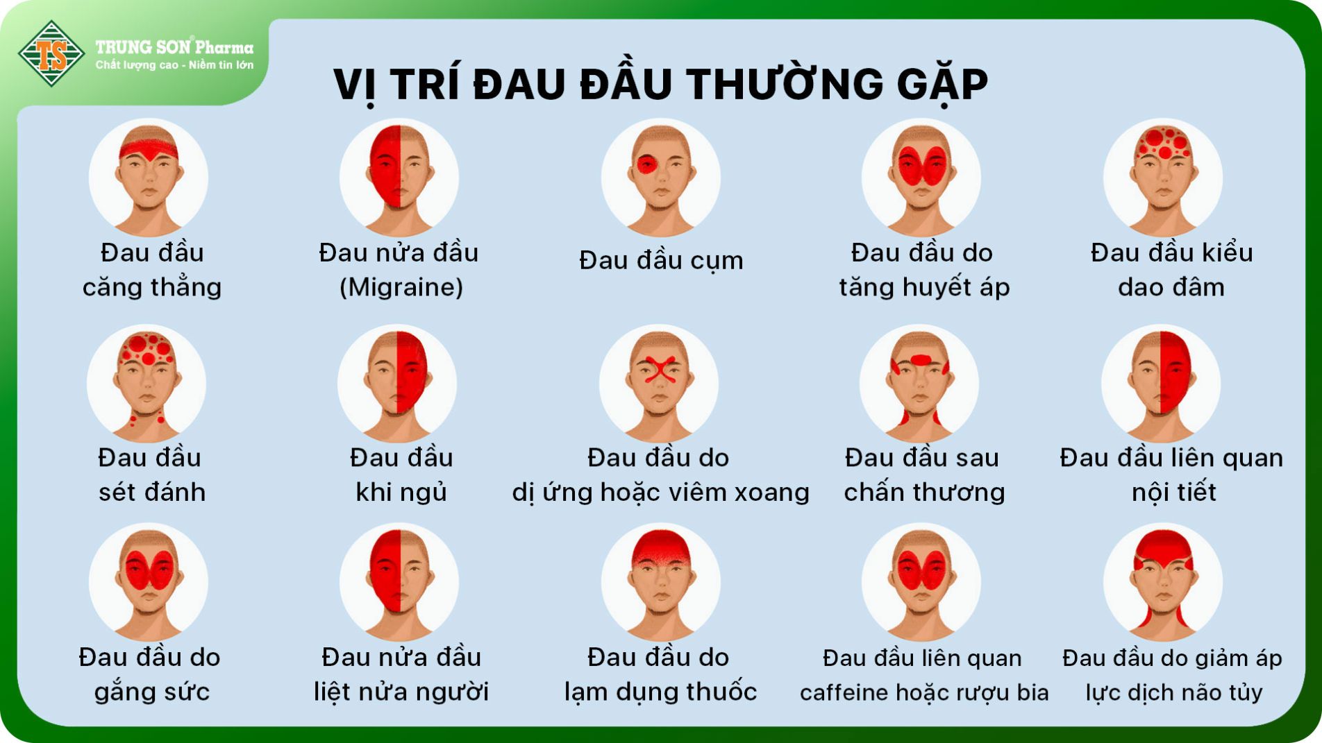 Sơ đồ vị trí đau đầu theo nguyên nhân