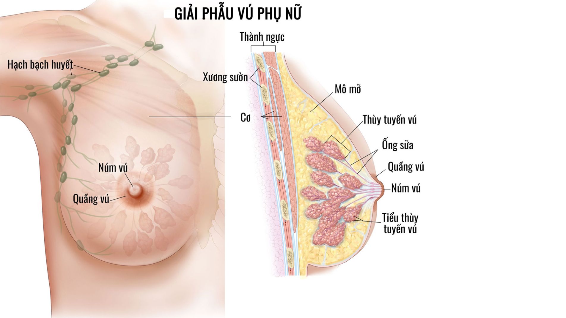 Ung thư vú là gì?