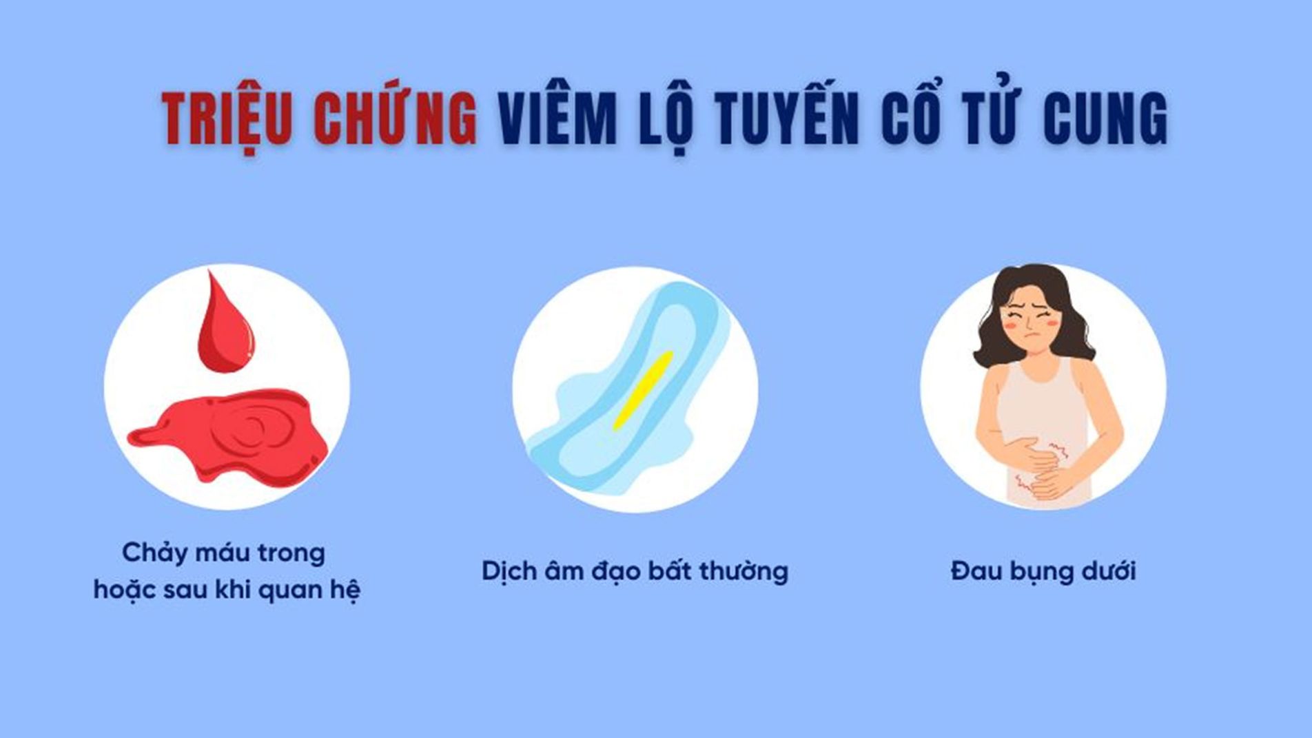(Các triệu chứng phổ biến của viêm lộ tuyến cổ tử cung như khí hư bất thường và đau bụng dưới)