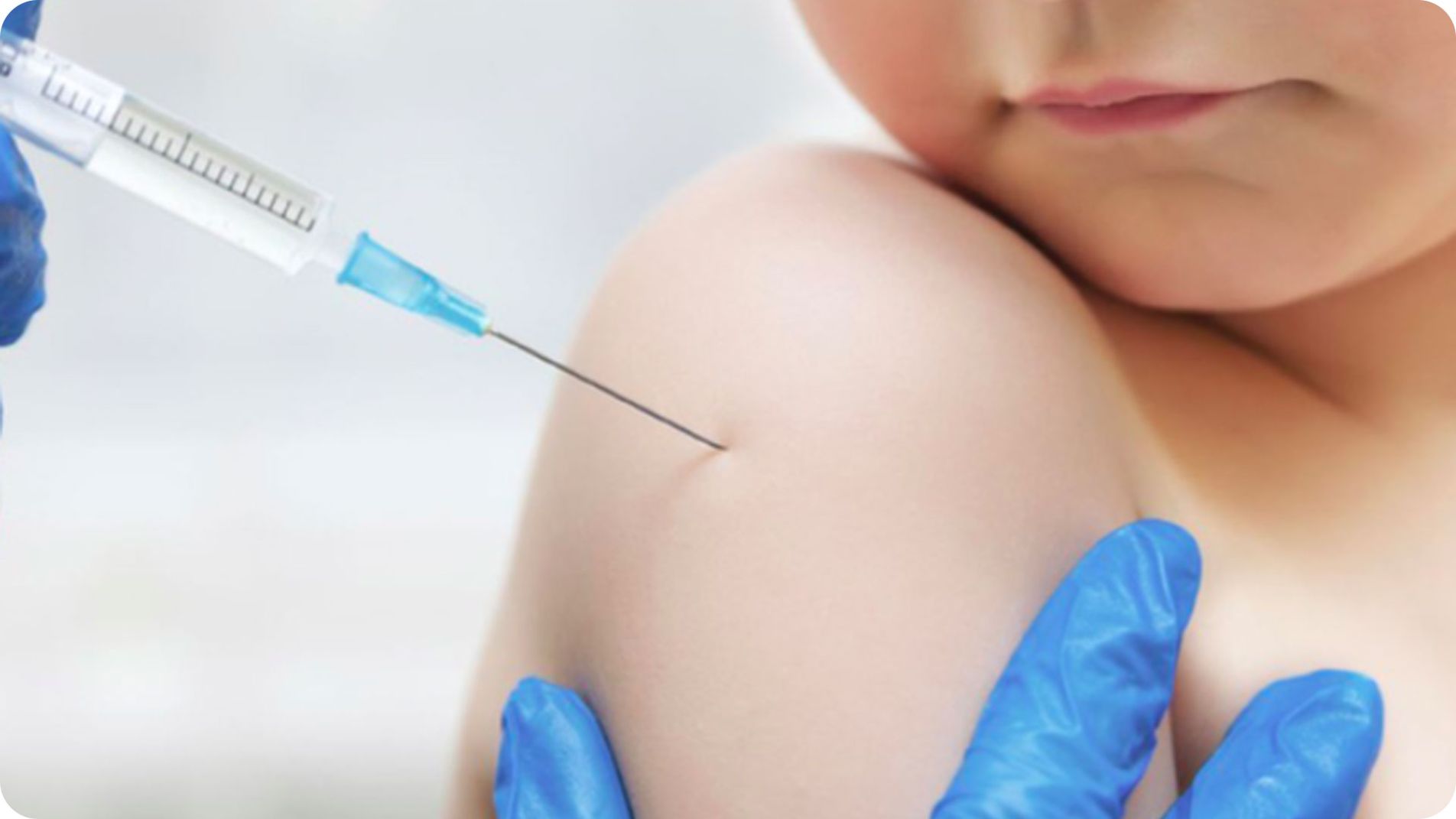 Tiêm vaccine MMR phòng bệnh sởi cho trẻ em
