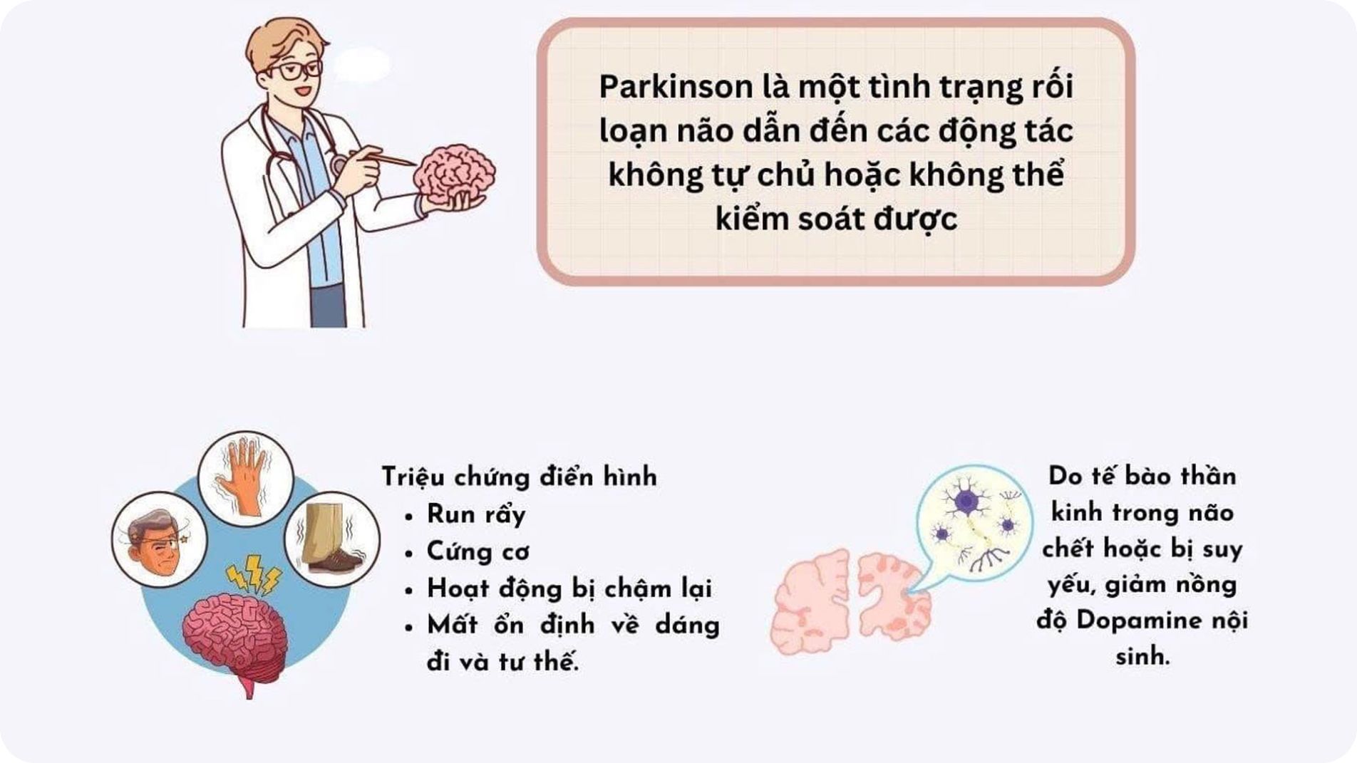Sơ đồ não bộ và mất tế bào dopamine trong bệnh Parkinson