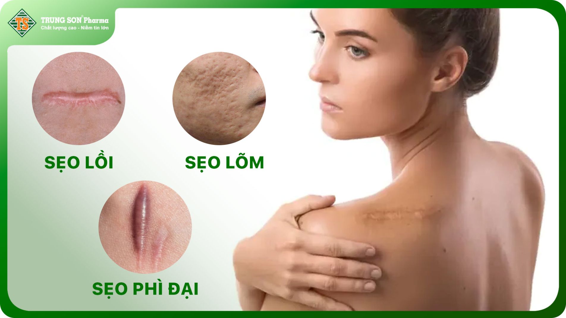 Hình ảnh các loại sẹo trên da bao gồm lõm, lồi và phì đại.