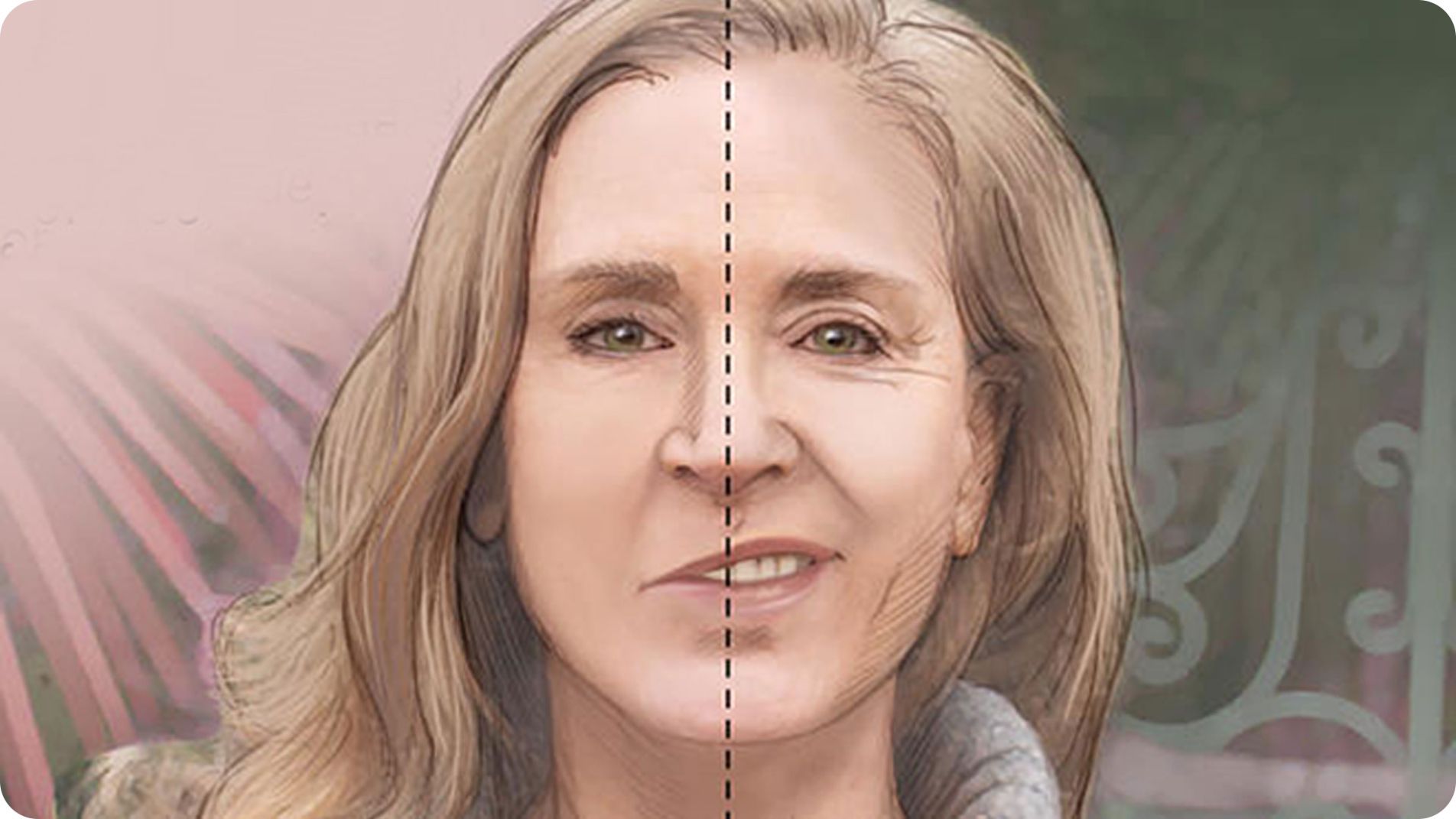 Dấu hiệu nhận biết sớm xuất huyết não theo quy tắc FAST